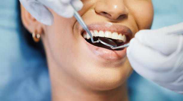 Best Emergency Wisdom Teeth Removal in Mount Hore, WI