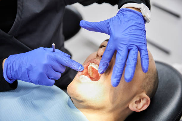 Best Emergency Treatment for Dental Infections or Abscesses in Mount Hore, WI